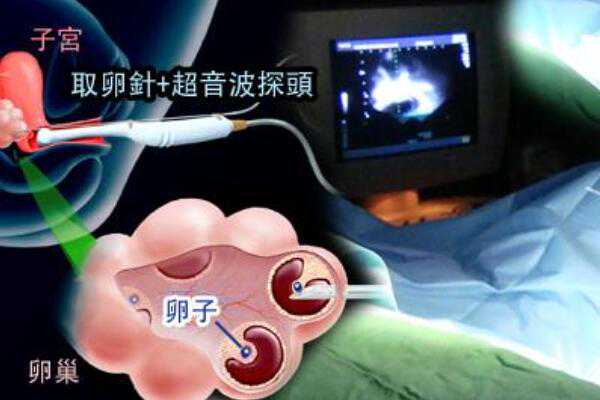 上海试管助孕生男孩|甘肃省妇幼保健院生殖医学中心诞生首例阻断“隐性遗传
