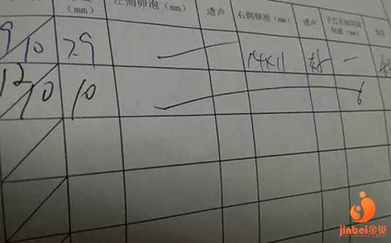 泸溪县捐卵安全吗_河南省人民医院可以做第三代试管婴儿吗？