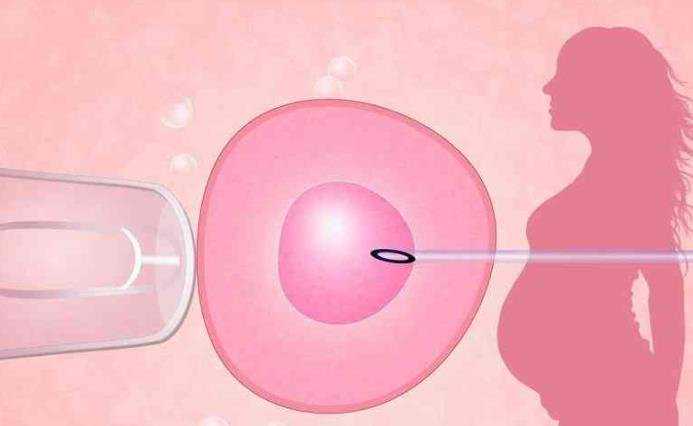 捐卵用什么针_人工授精和试管婴儿的4个区别，教你挑选合适的助孕技术